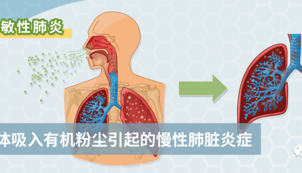 就因为家里养了一只猫，差点命丧黄泉！
