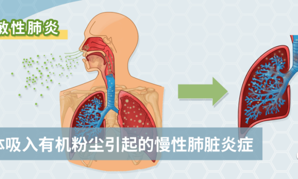 就因为家里养了一只猫，差点命丧黄泉！